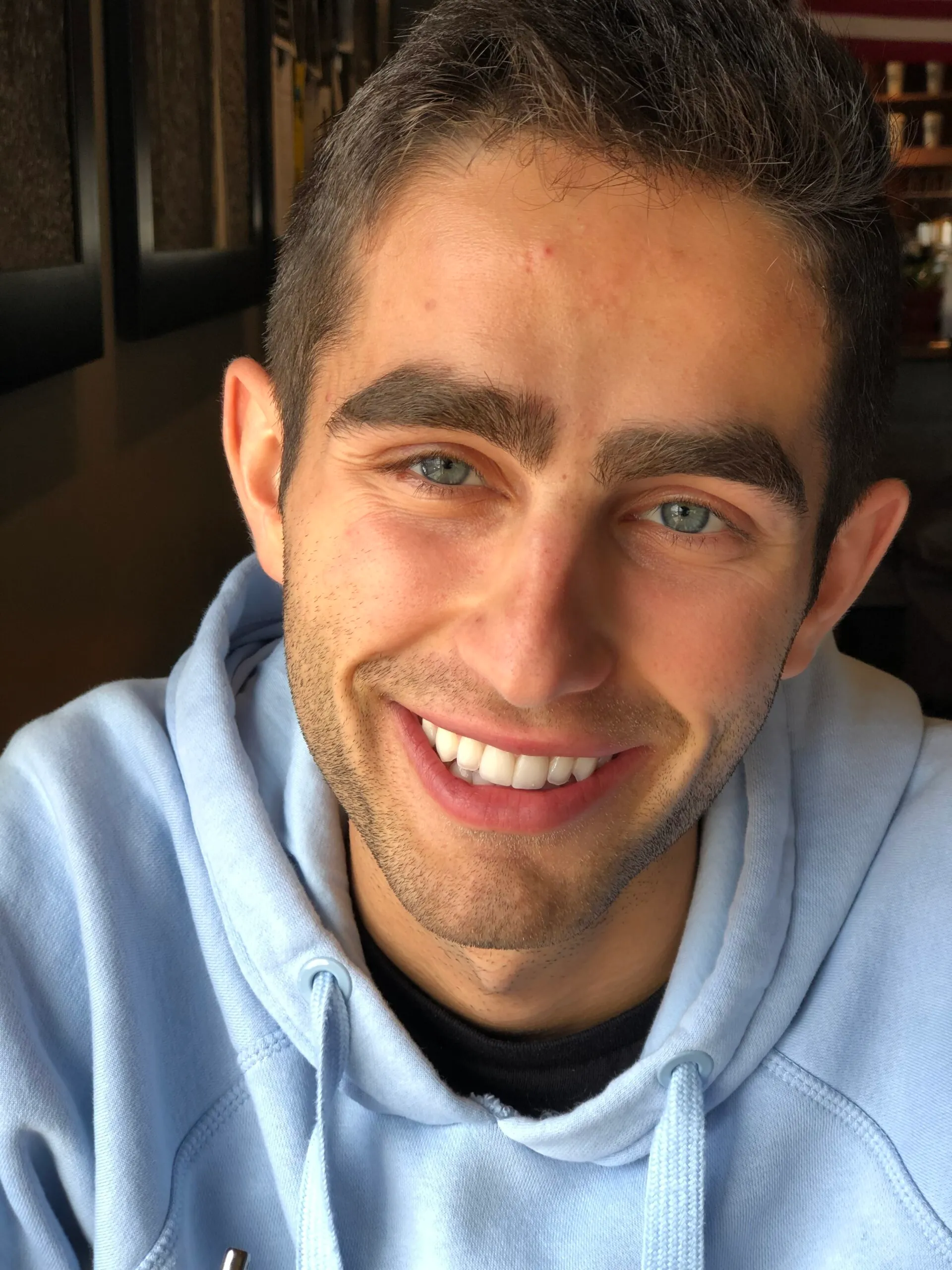 Photo showing skin before using the skincare in this article